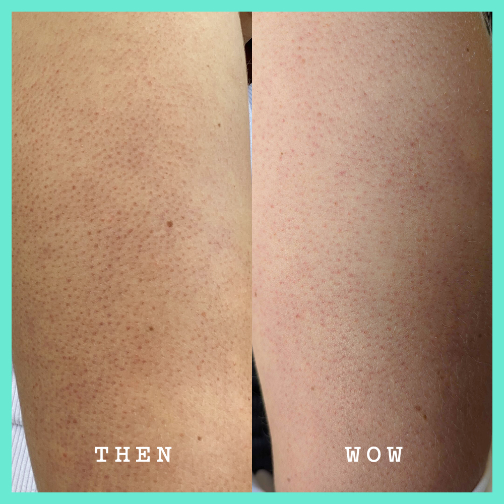 Glycolic Body Scrub