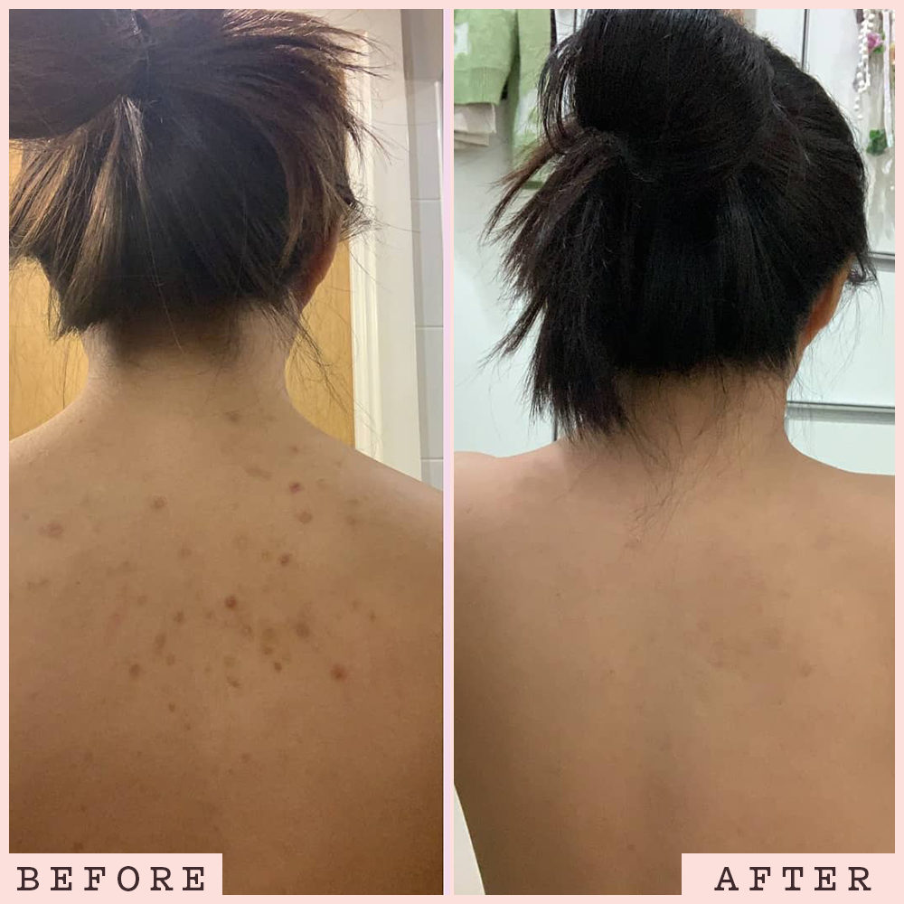 Original Coffee Scrub Body Exfoliant frank body